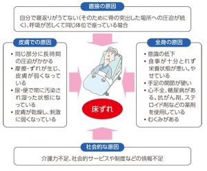 617 褥瘡 じょくそう スキンテア どう防ぐ 医和生会看護職研修 地域の医療と生活をサポートする いわき市の医療法人 医和生会 いわきかい 山内クリニック